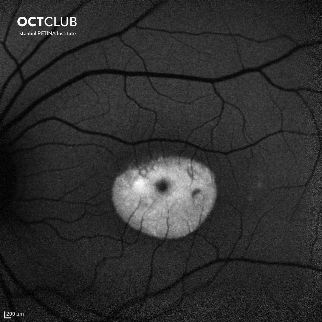 OCT Club - OCT Club added a new photo.