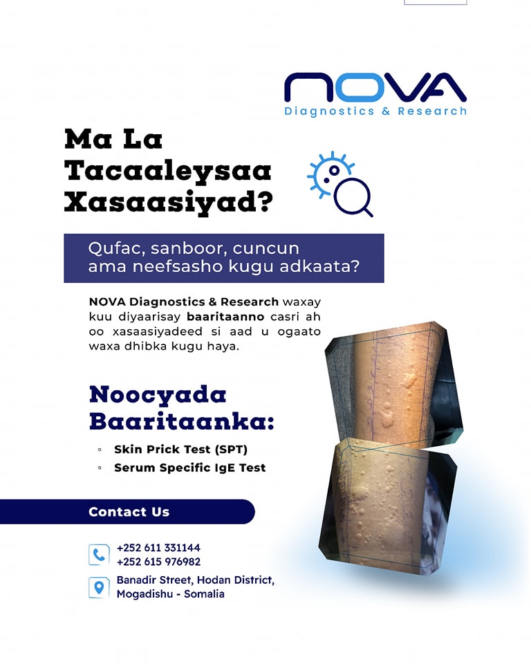 Nova Diagnostics & Research | Mogadishu