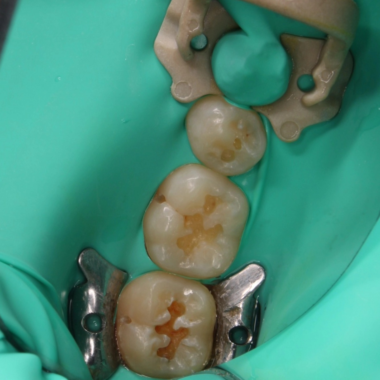 Tree Dent Consultorio Dental | Tuxtla Gutiérrez