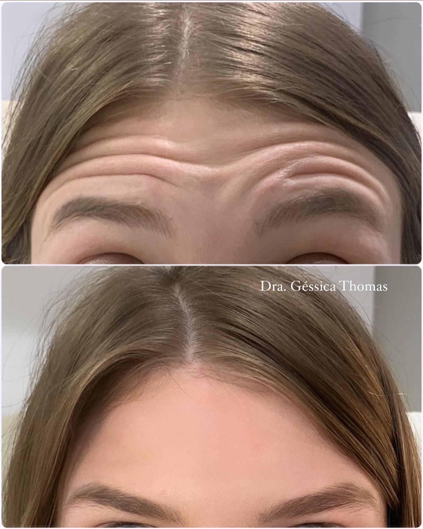 Alguns dos Retornos de botox dessa... - Dra. Géssica Thomas