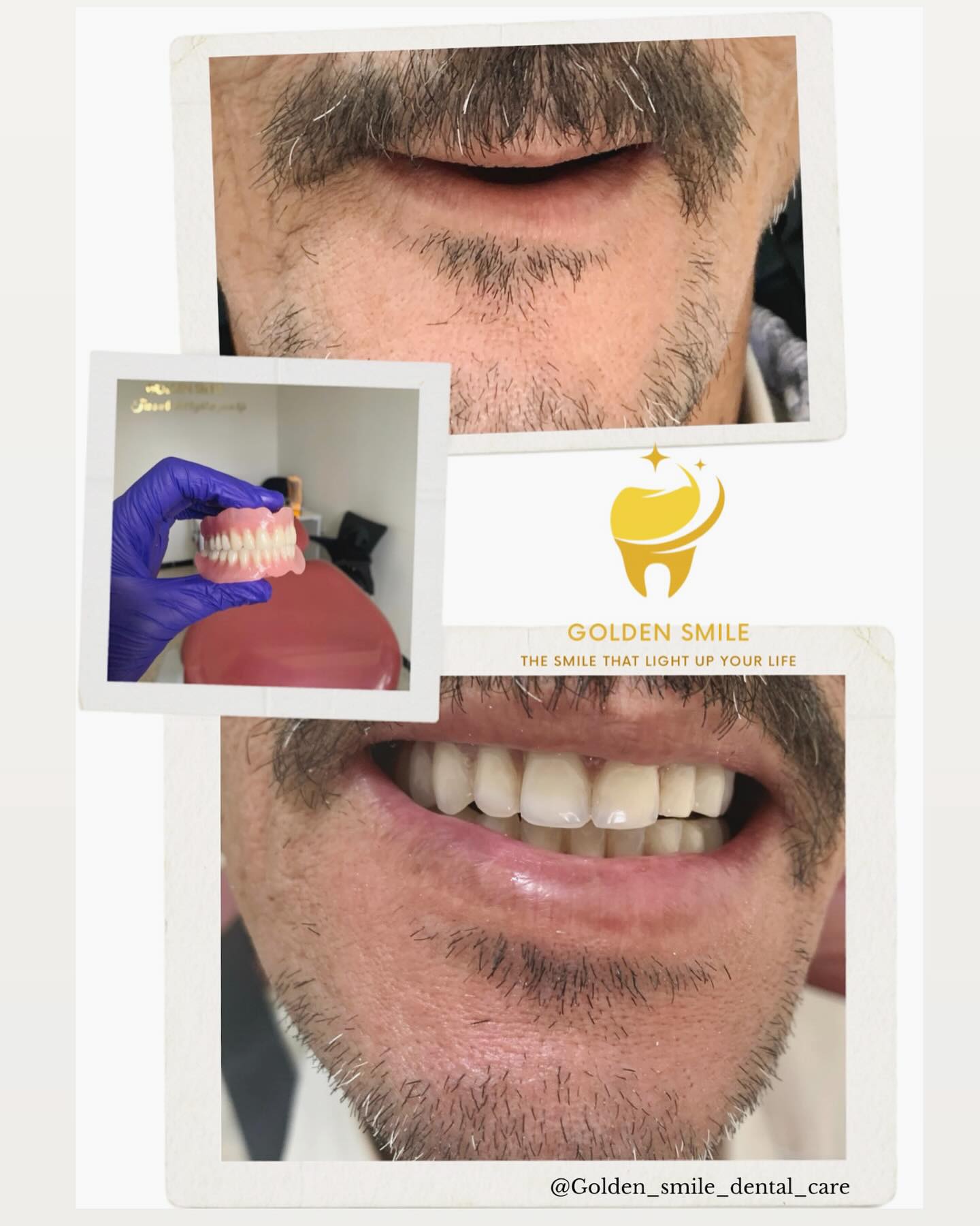 golden-smile-dental-care-constantine