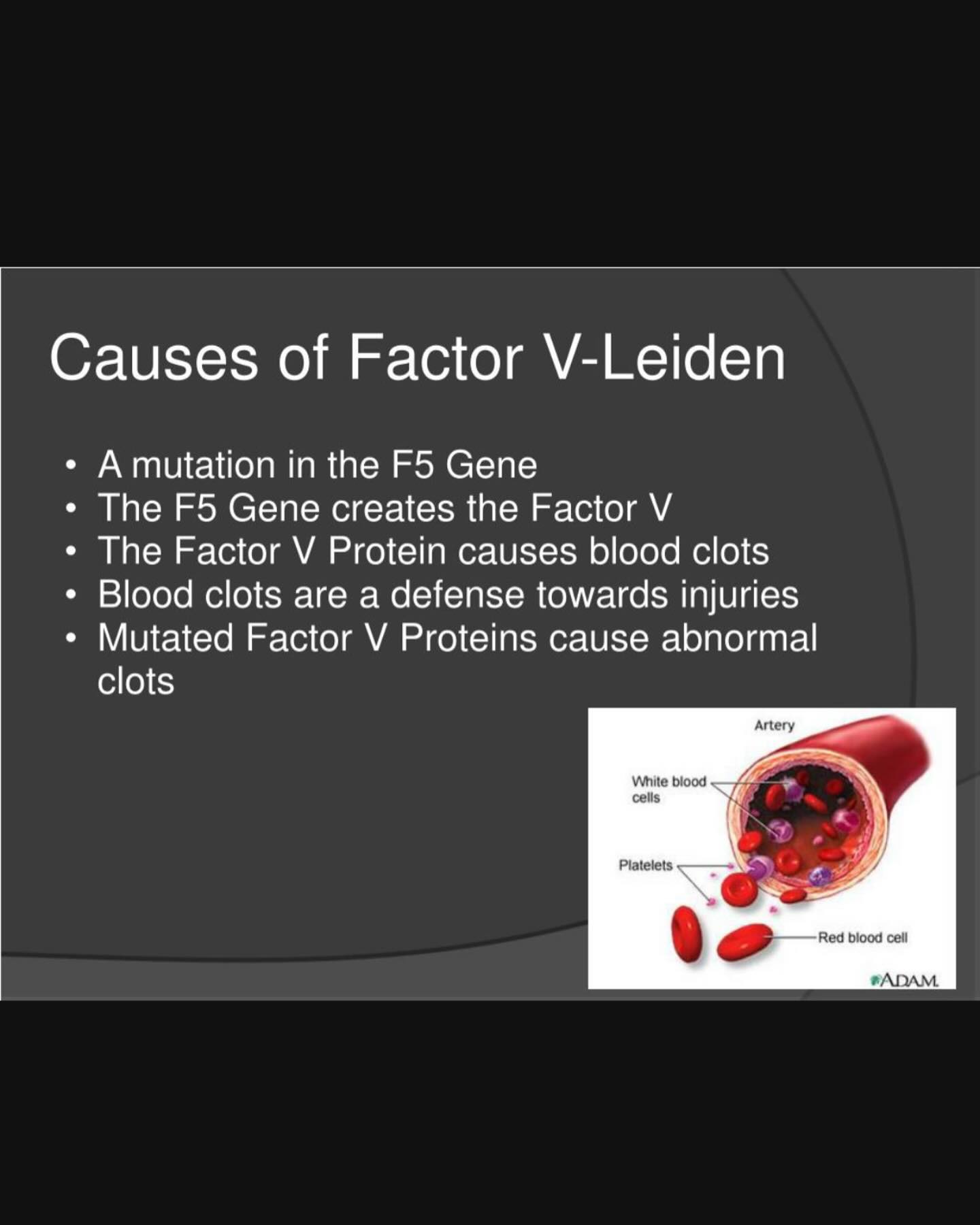 Factor V Leiden … increases clotting ability Factor V Leiden** thrombophilia is an inherited disorder of blood clotting. **Factor V Leiden** is the name of a specific gene mutation that results in