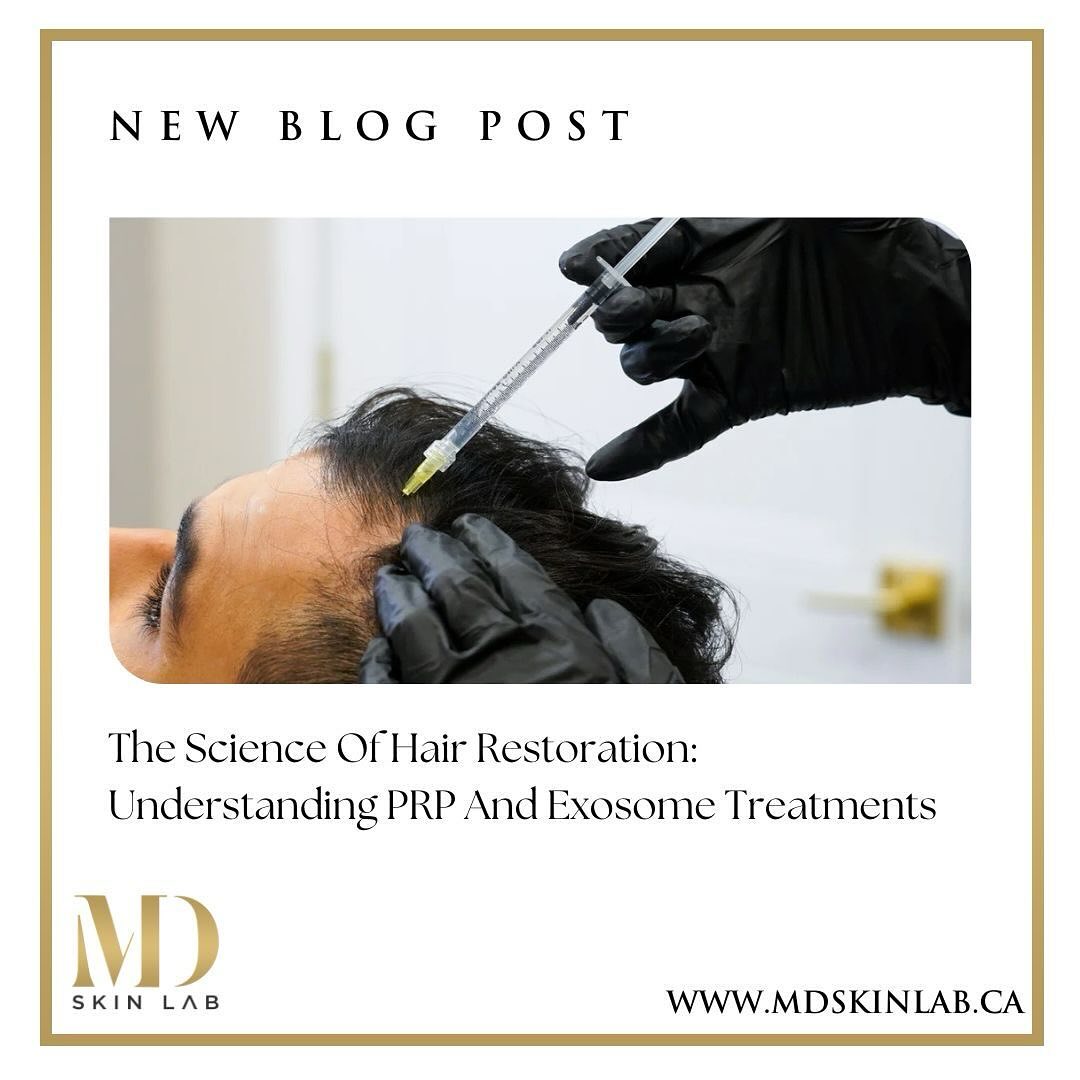 MD - Have you heard of the newest treatment in regenerative medicine ...