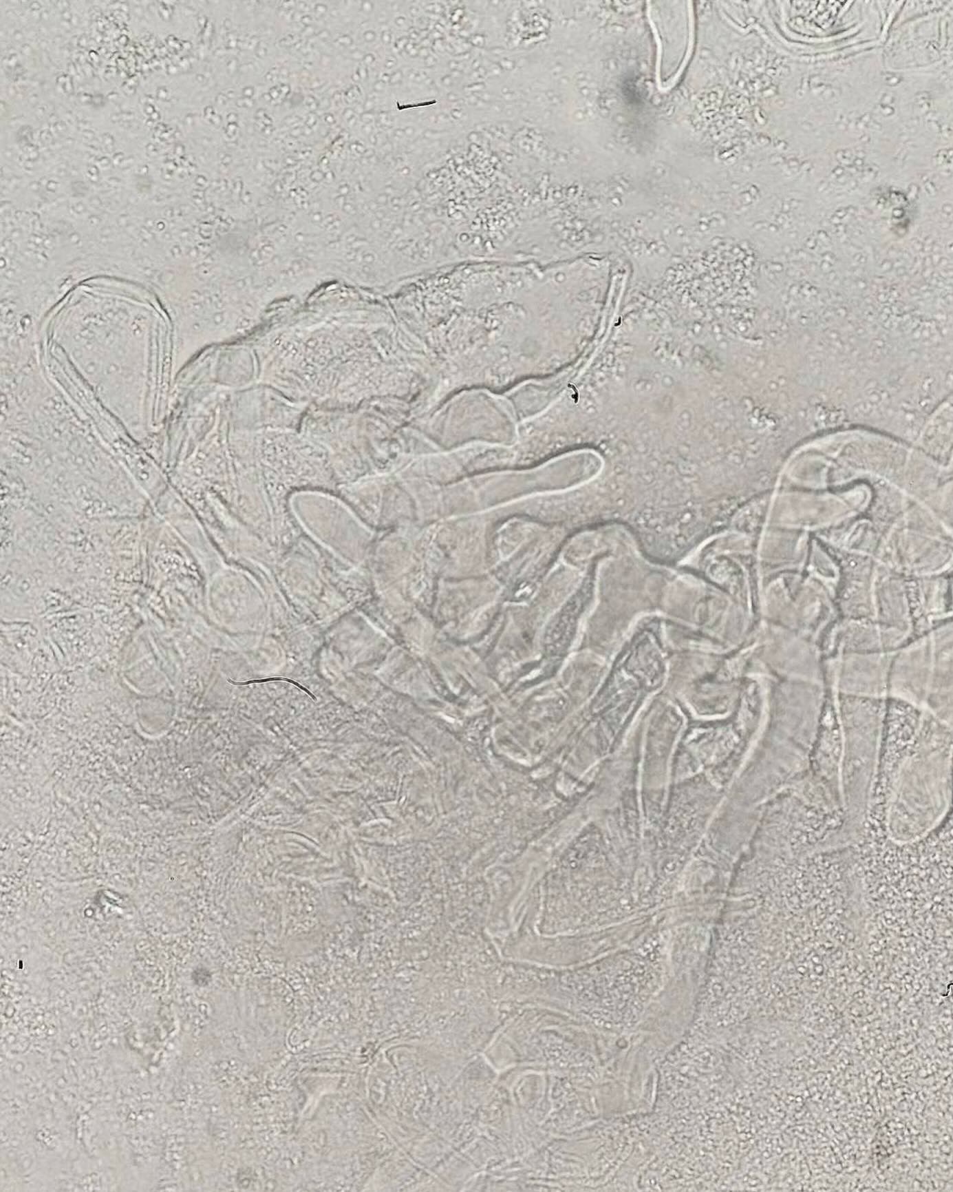 Germs of Chula - 🦠 Non-septate mold เชื้อดูเหมือนง่ายๆ... | Facebook