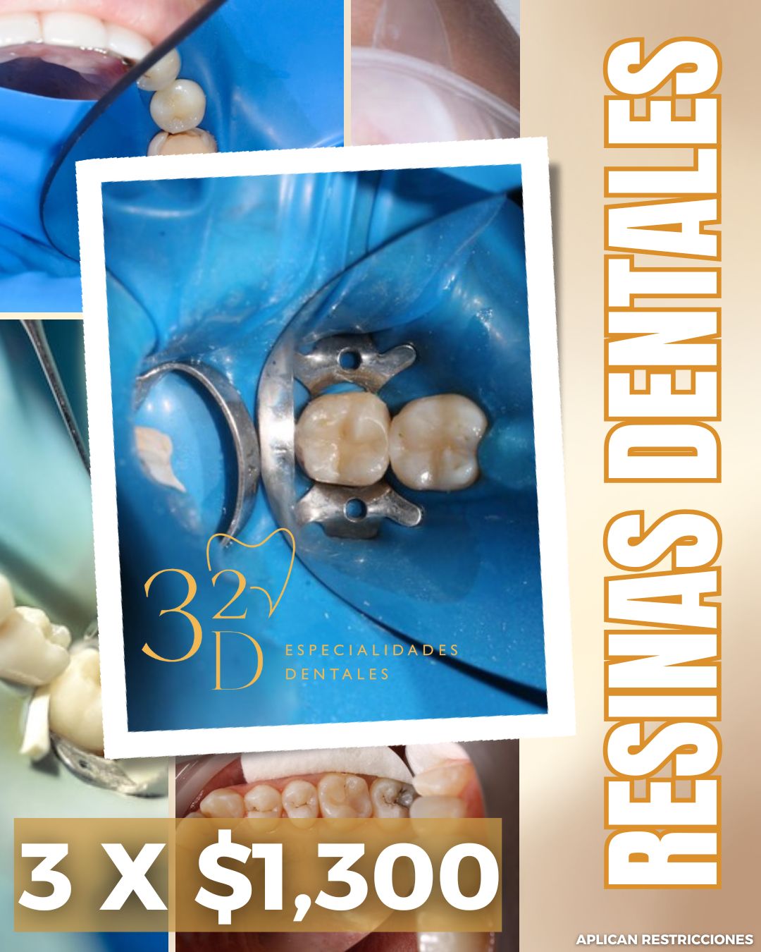 32D - ¿Necesitas resinas dentales?🦷 ¡Ha llegado el momento de agendar ...