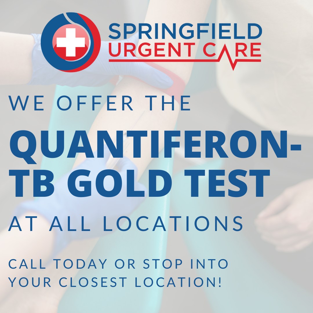 Springfield - 💉 Need a TB test for work or school? We’ve got you ...