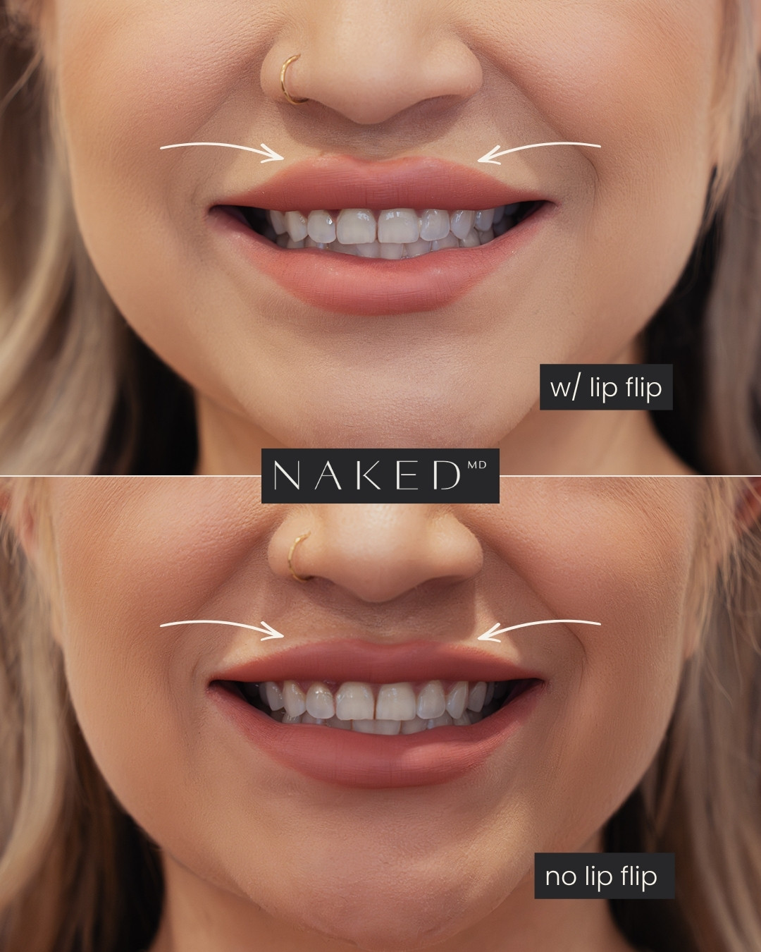 NAKEDᴹᴰ