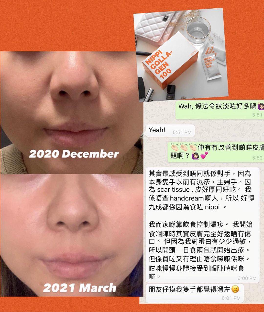 Deerville - 【用家分享🏵️Nippi 改善💥濕疹主婦手+法令紋】 🙋🏻‍♀️客人的起心肝堅持食Nippi，食食下發現濕疹主婦手 ...
