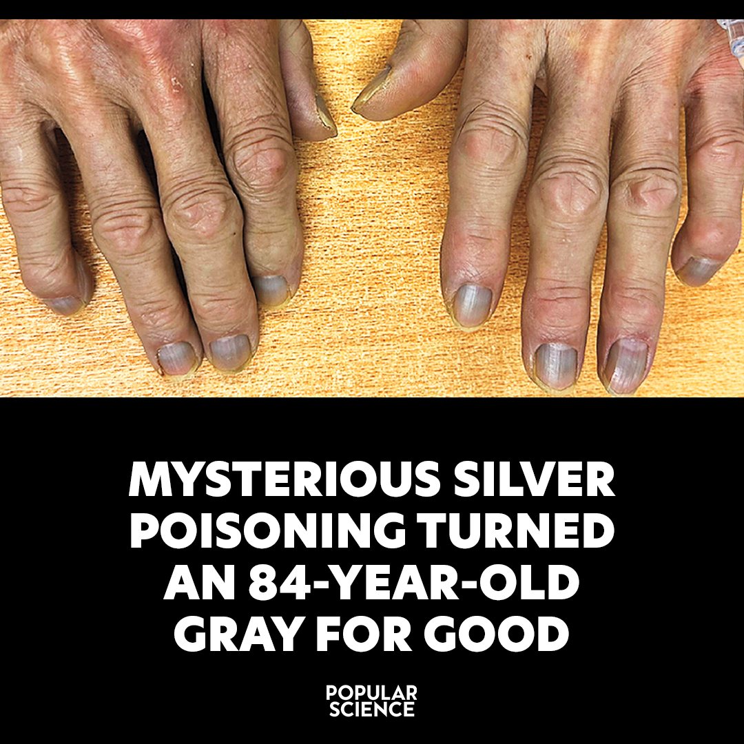 Popular Science - Doctors discovered gray granules in the...