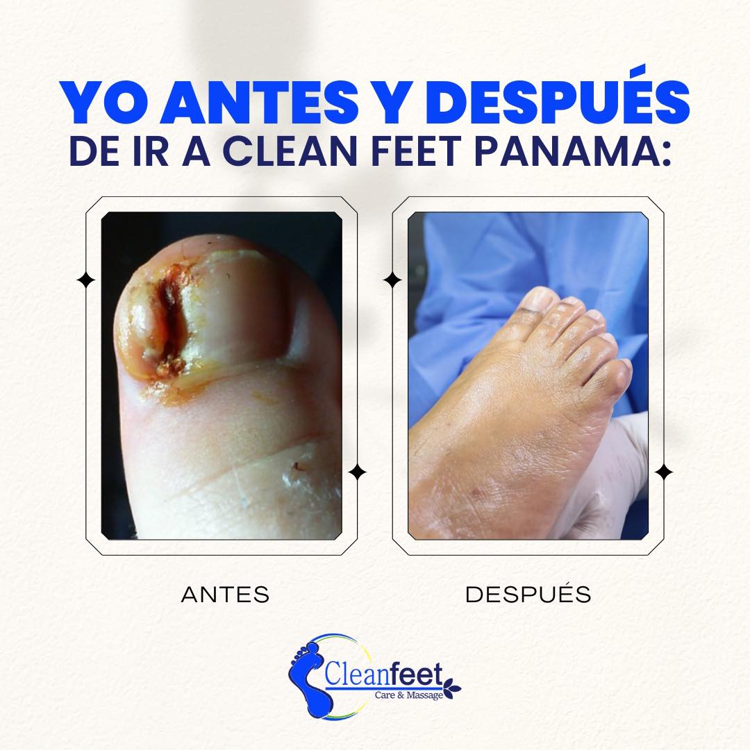 CLEAN - 👣 ¡Lo que tus pies necesitan y merecen! ¿Listo para un antes y ...