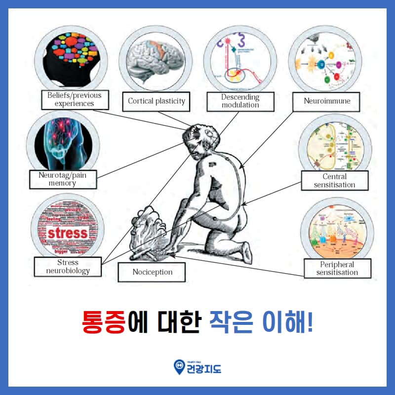 통증에 대한 작은 이해! 일반적으로 우리는 ‘통증’을 ‘구조와 조직... - 건강지도 - Health map | Facebook