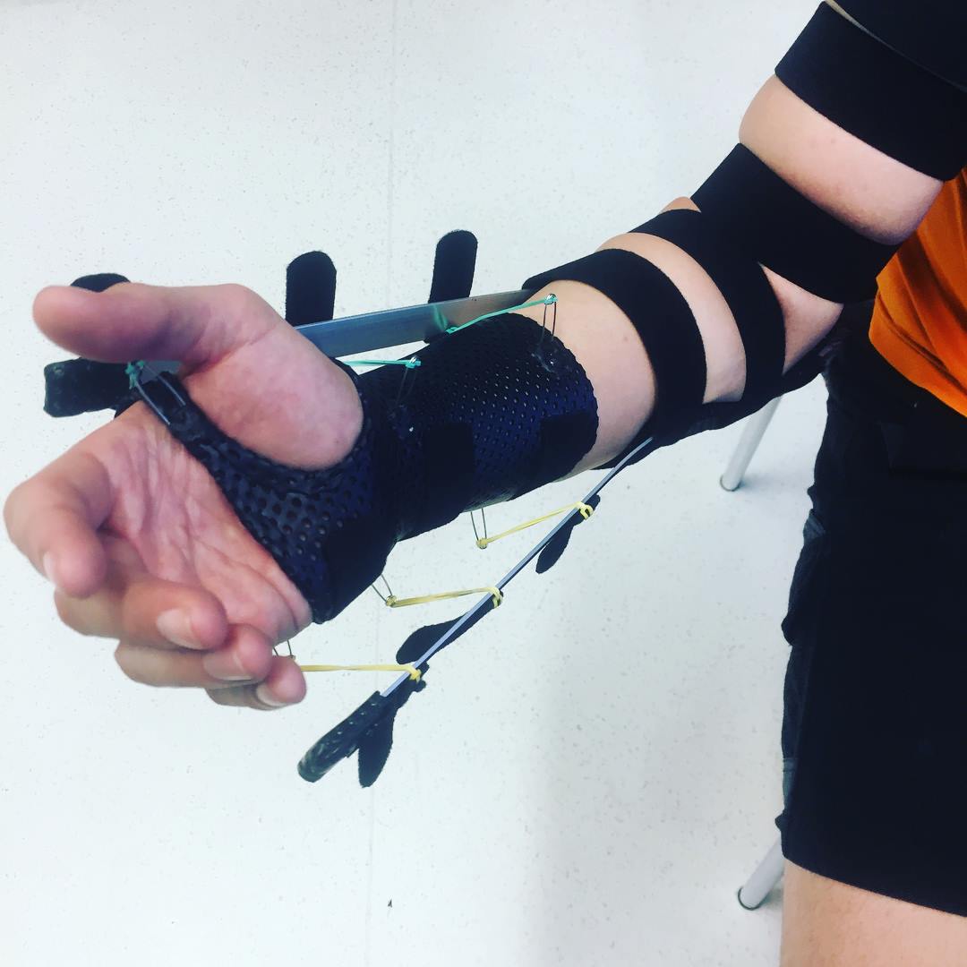 A collelo splint to help increase... - Hand Therapy Group | Facebook