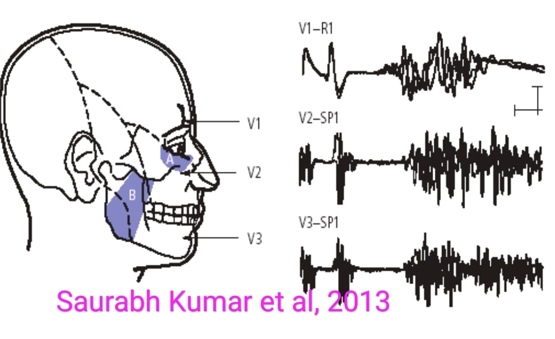 Clinical Neurophysiology... - Clinical Neurophysiology Plus