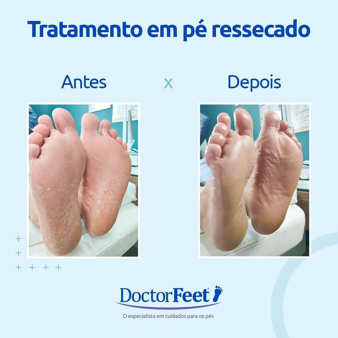 ⚠️O ressecamento dos pés é... - Doctor Feet Estação Cuiabá