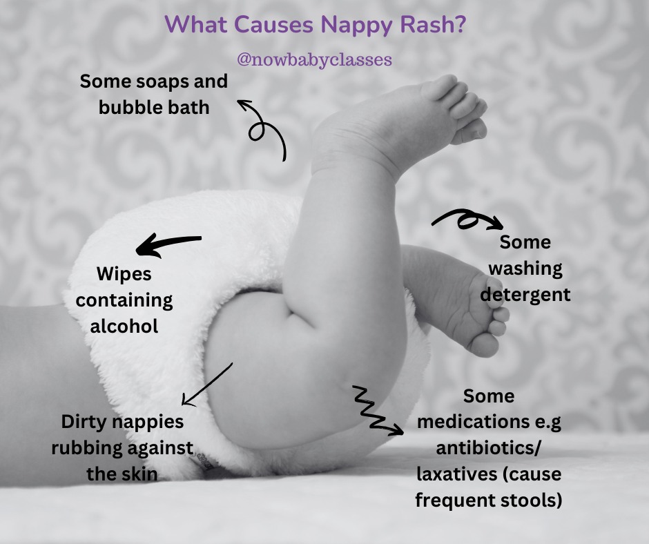 NowBaby - Nappy rash is super common 🧷– but that doesn’t make it any ...