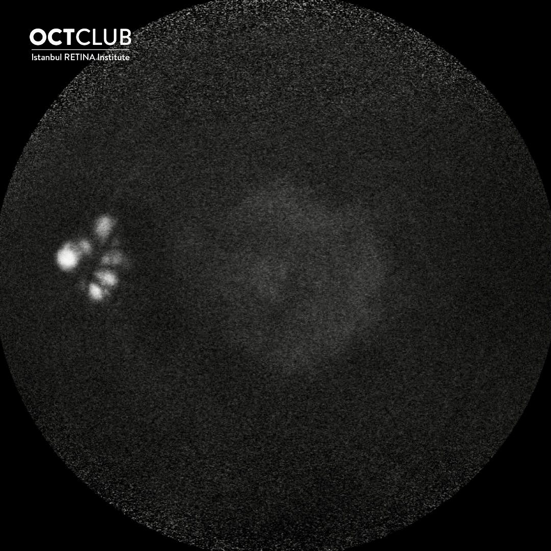 OCT Club