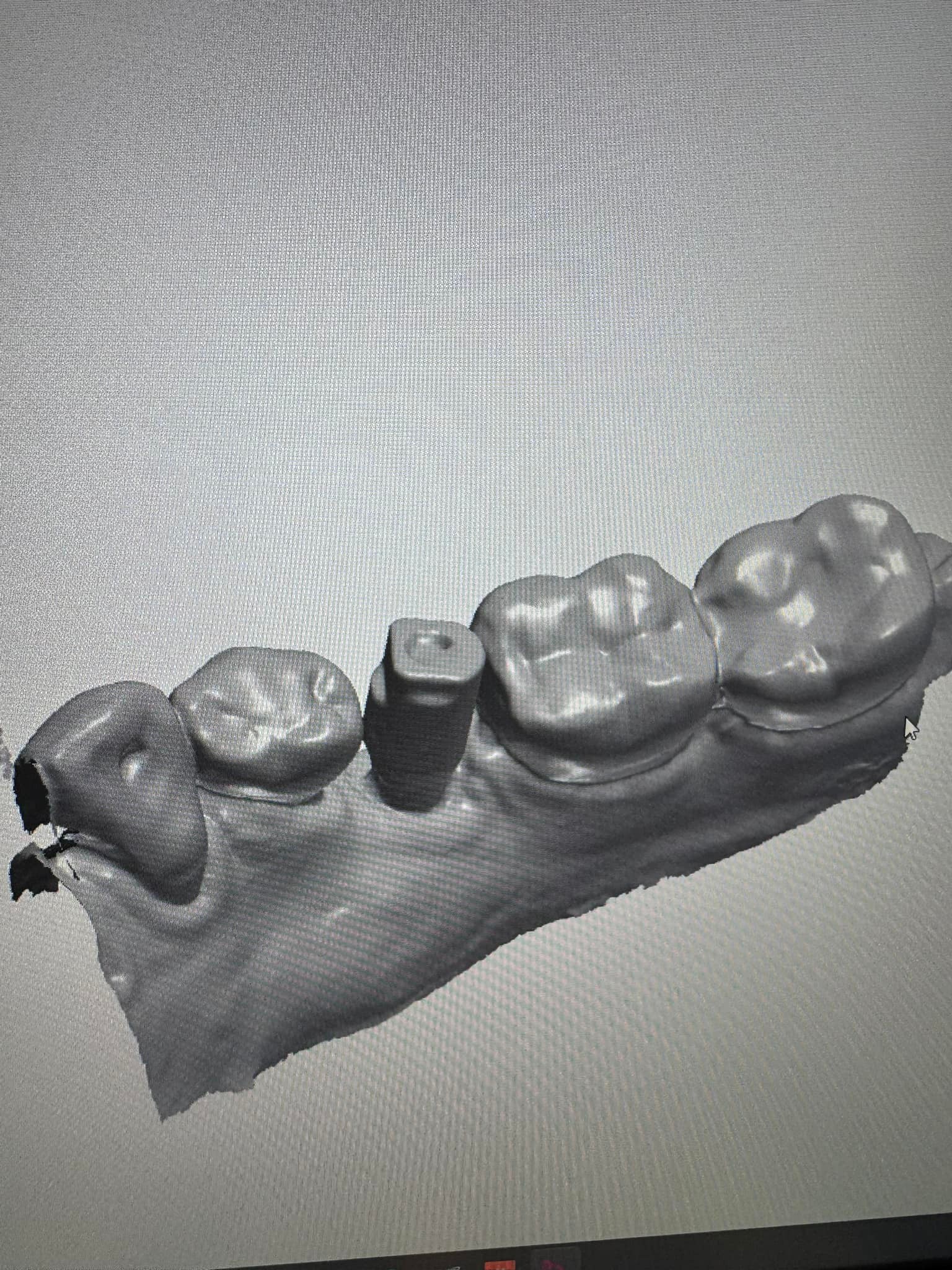 3Shape Study Group | Hello, Can anybody recognize what scan body was ...