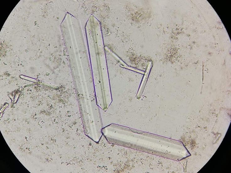 Identify Crystals .?... - Medical Laboratory Scientist - MLS | Facebook