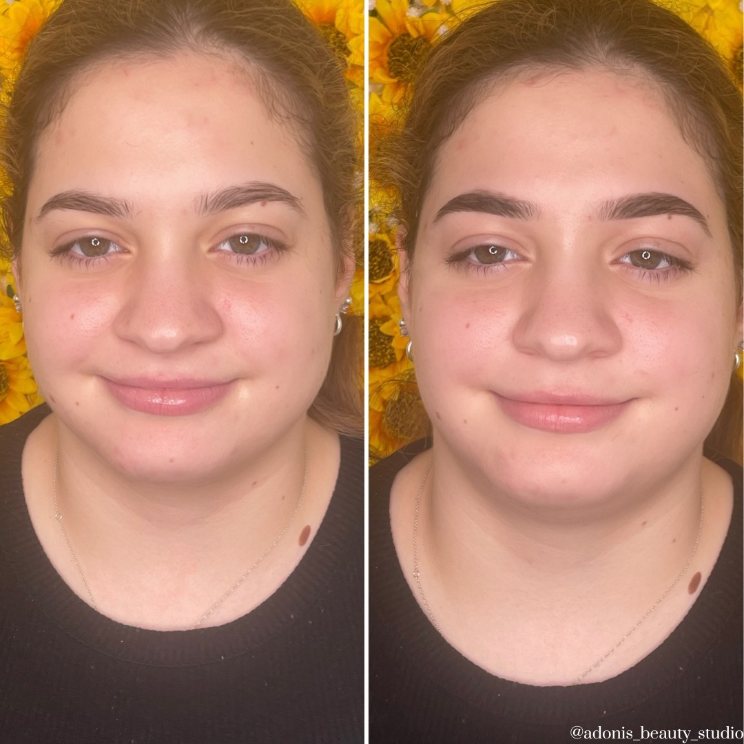 Adonis Beauty Studio | Ripley QLD