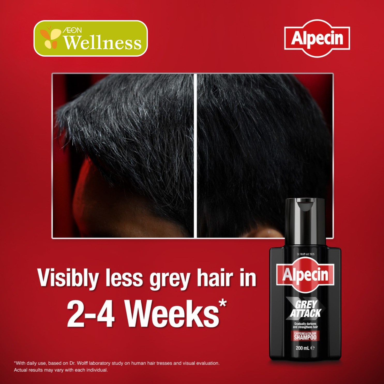 glutathione grey hair reddit Do you have problems with hair? Try the New Alpecin Grey Attack Caffeine & Colour Shampoo for visibly less grey in 2-4 weeks*. This shampoo darkens grey hair with each glutathione supplement breastfeeding l Size:200 g clean ingredients