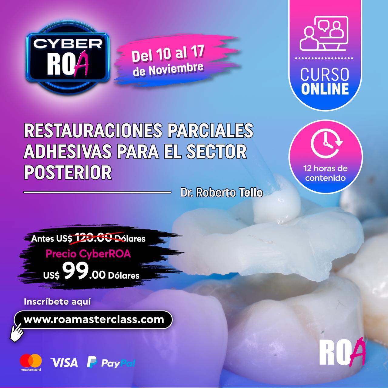 ROA - Este es el curso de Restauraciones Parciales Adhesivas donde se ...