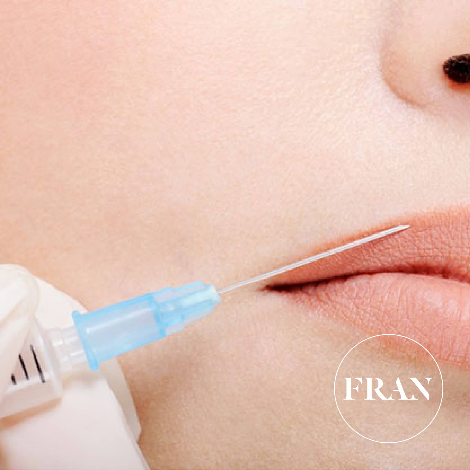 Clínica Fran - Estética Facial - Tratamiento con ToxinaBotulínica (ej ...