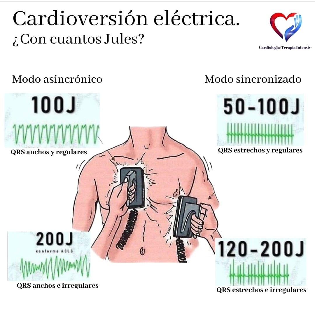 #cardiologiaterapiaintensi... - Cardiologia/Terapia intensiva.
