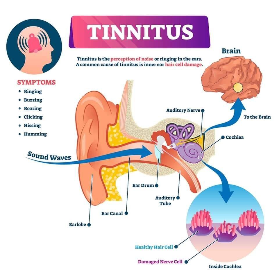 If you frequently hear a buzzing in your ears, you may be suffering from tinnitus. Find out more about the causes and symptoms of tinnitus here: http://bit.ly/2HqOee1