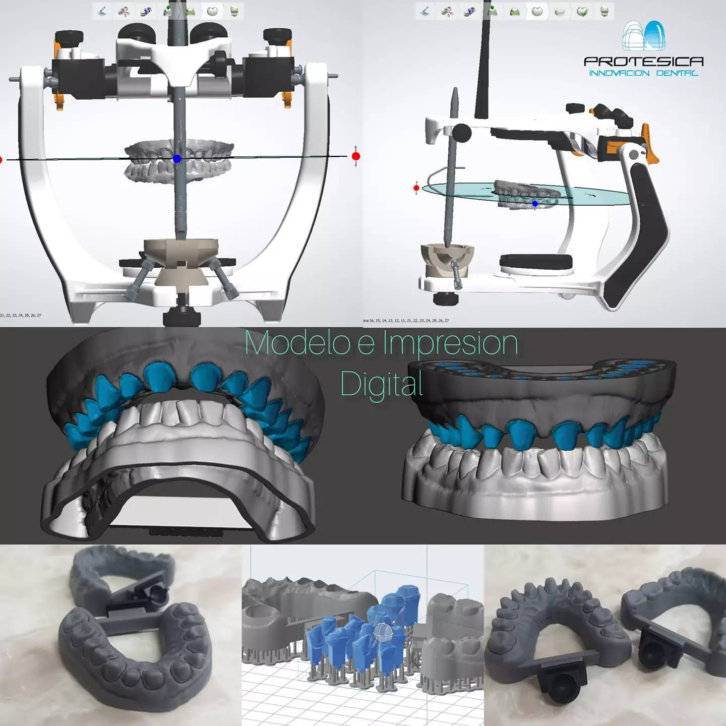 Protesica Innovacion Dental Cancun | Cancún