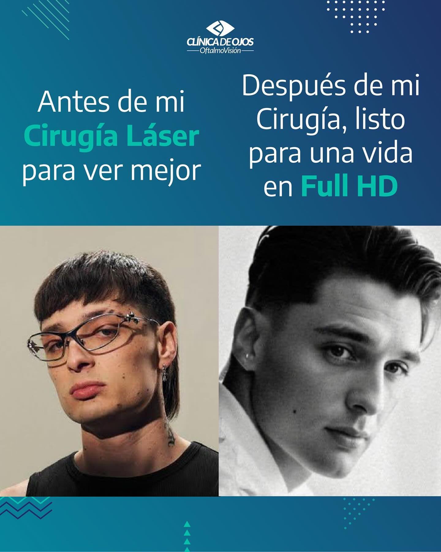 La Cirugía Láser es la... - Clínica de Ojos Oftalmovisión