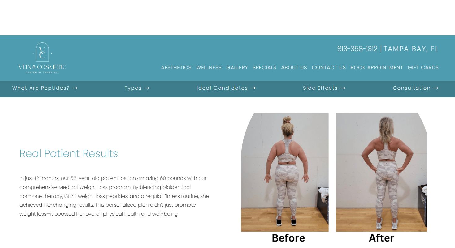 cjc-1295 ipamorelin fat loss results before and after reddit CJC-1295 + Ipamorelin Peptide Therapy Los Angeles The Peptide Labs | High-Purity