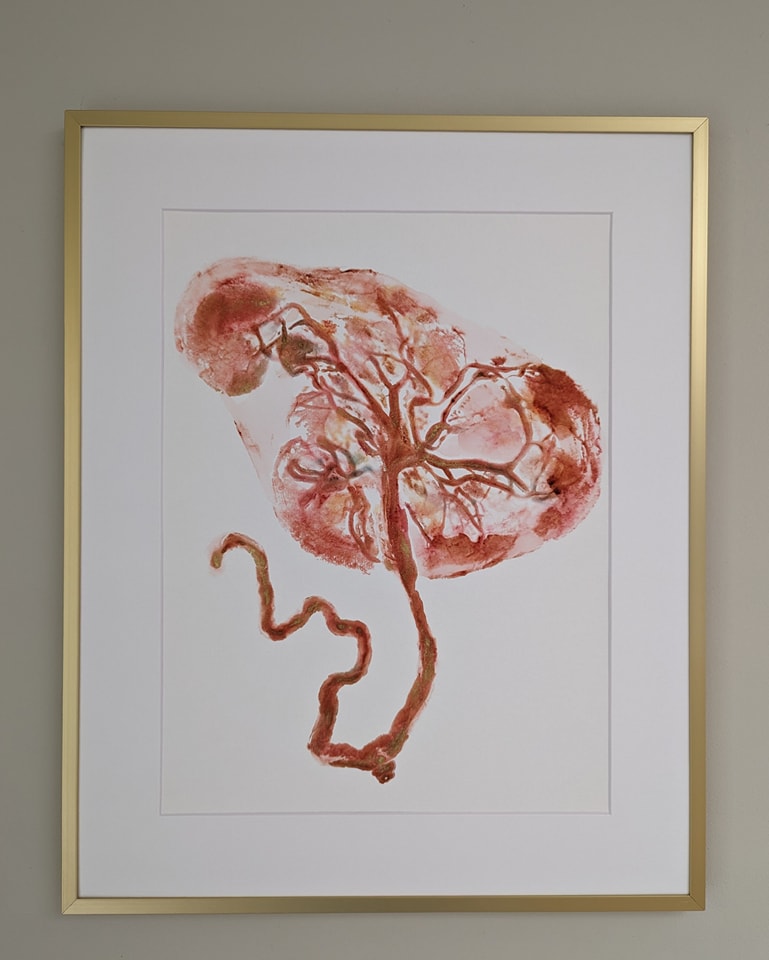 Tree of Life • Placenta Art