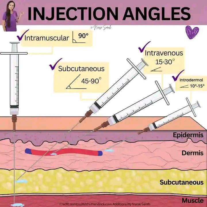 Nursing and Midwifery Knowledge | Angles of injection made easy for ...