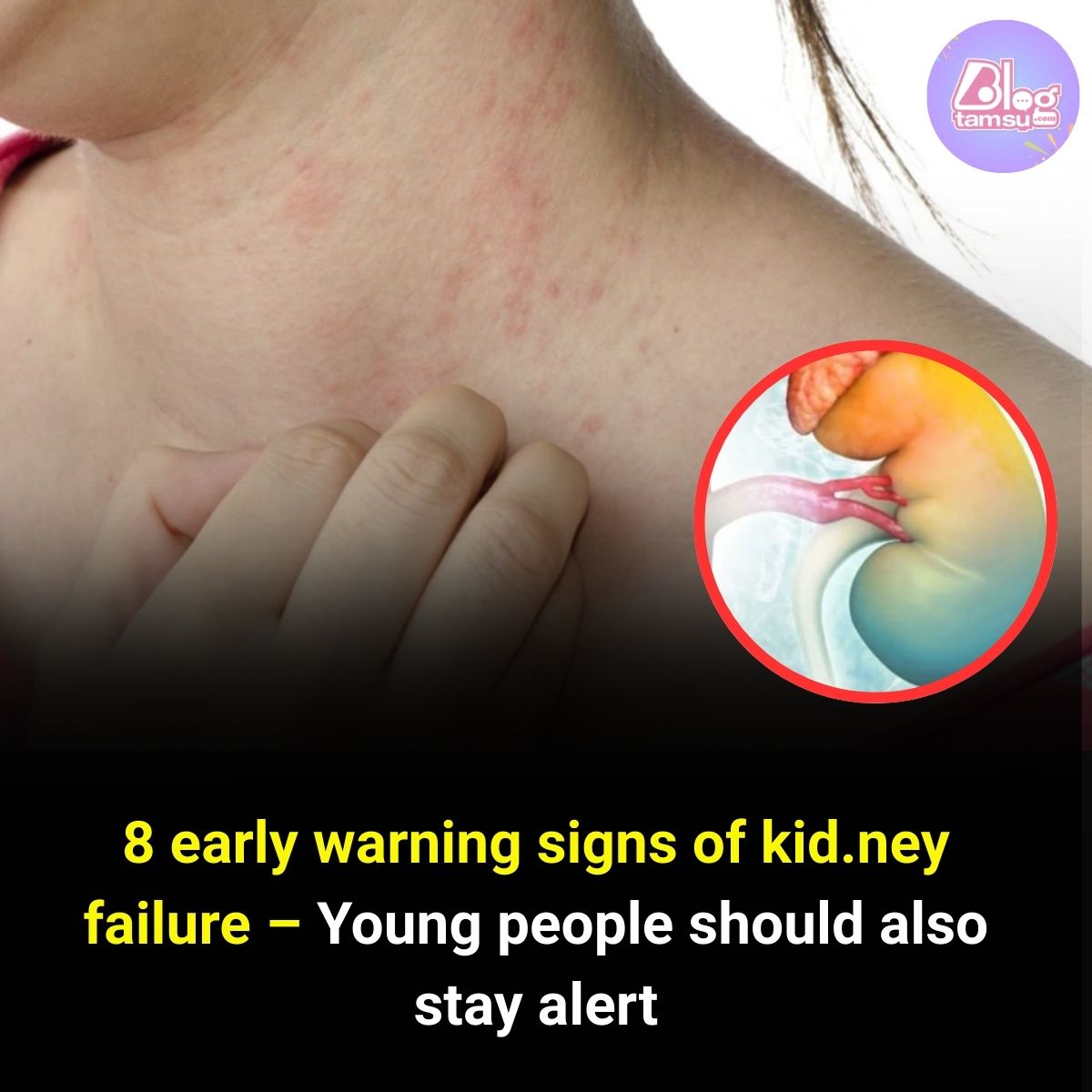 Blogtamsu - Early detection plays a vital role in successful treatment ...