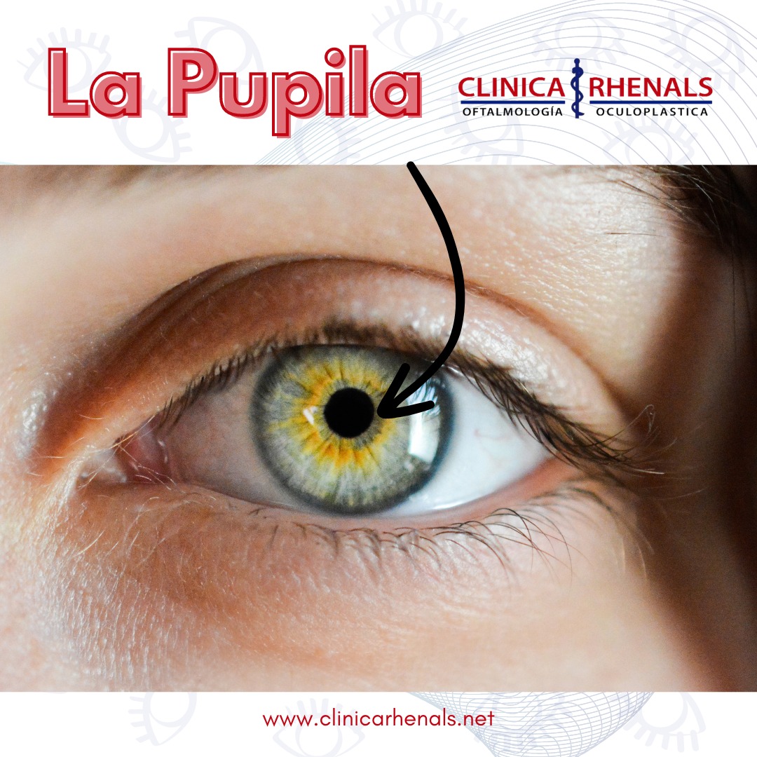 🤓Q... - Clínica Rhenals Oftalmológica y Cirugía Plástica, A.C. | Facebook