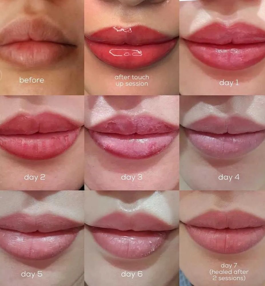 Vitamin C lip treatment for lip tattoo longevity